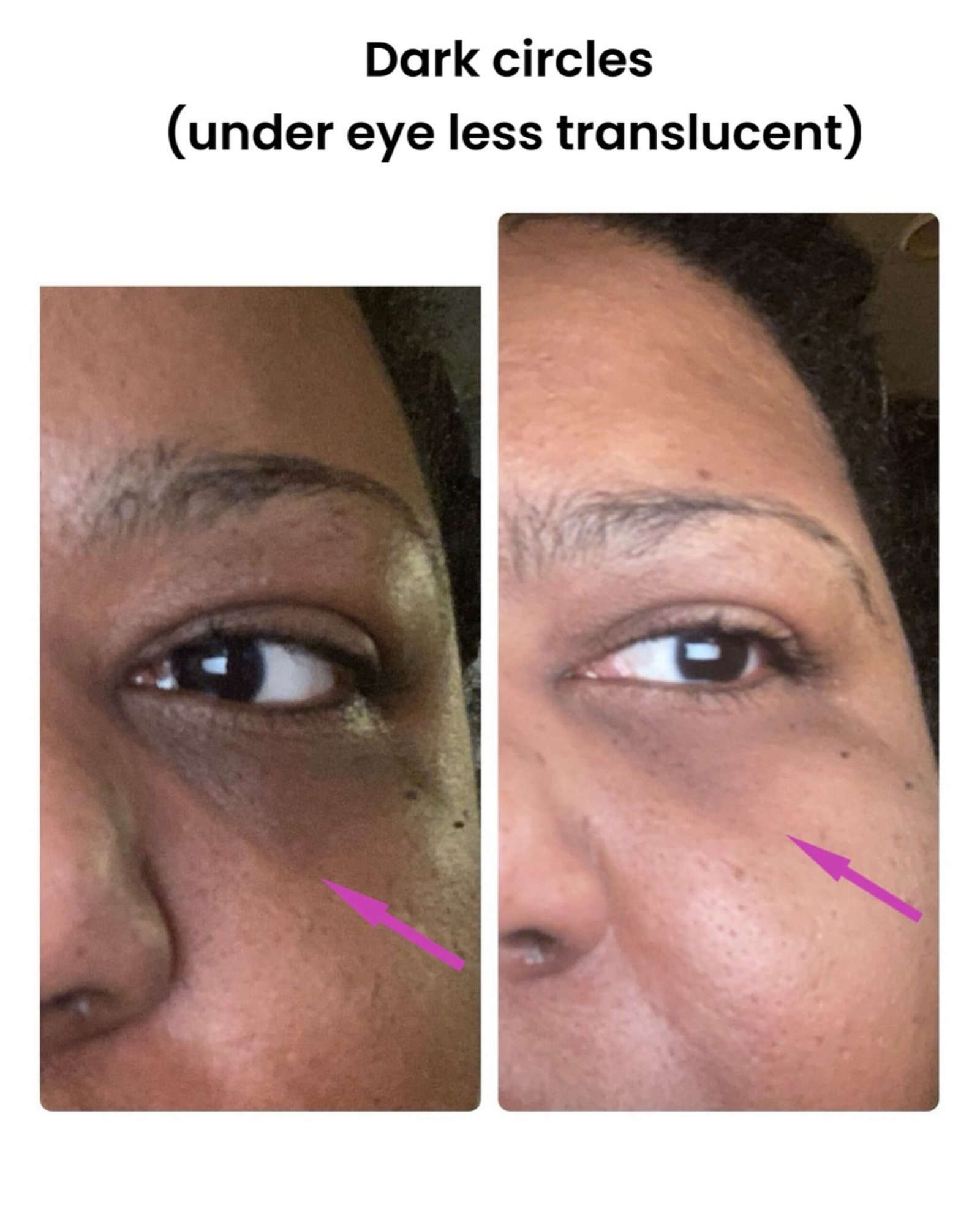 The INKEY List Retinol Eye Cream - Image 5