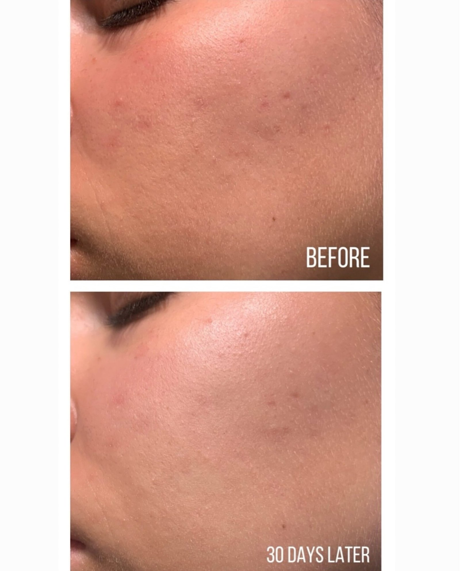 AXIS-Y Dark Spot Correcting Glow Serum - Image 5