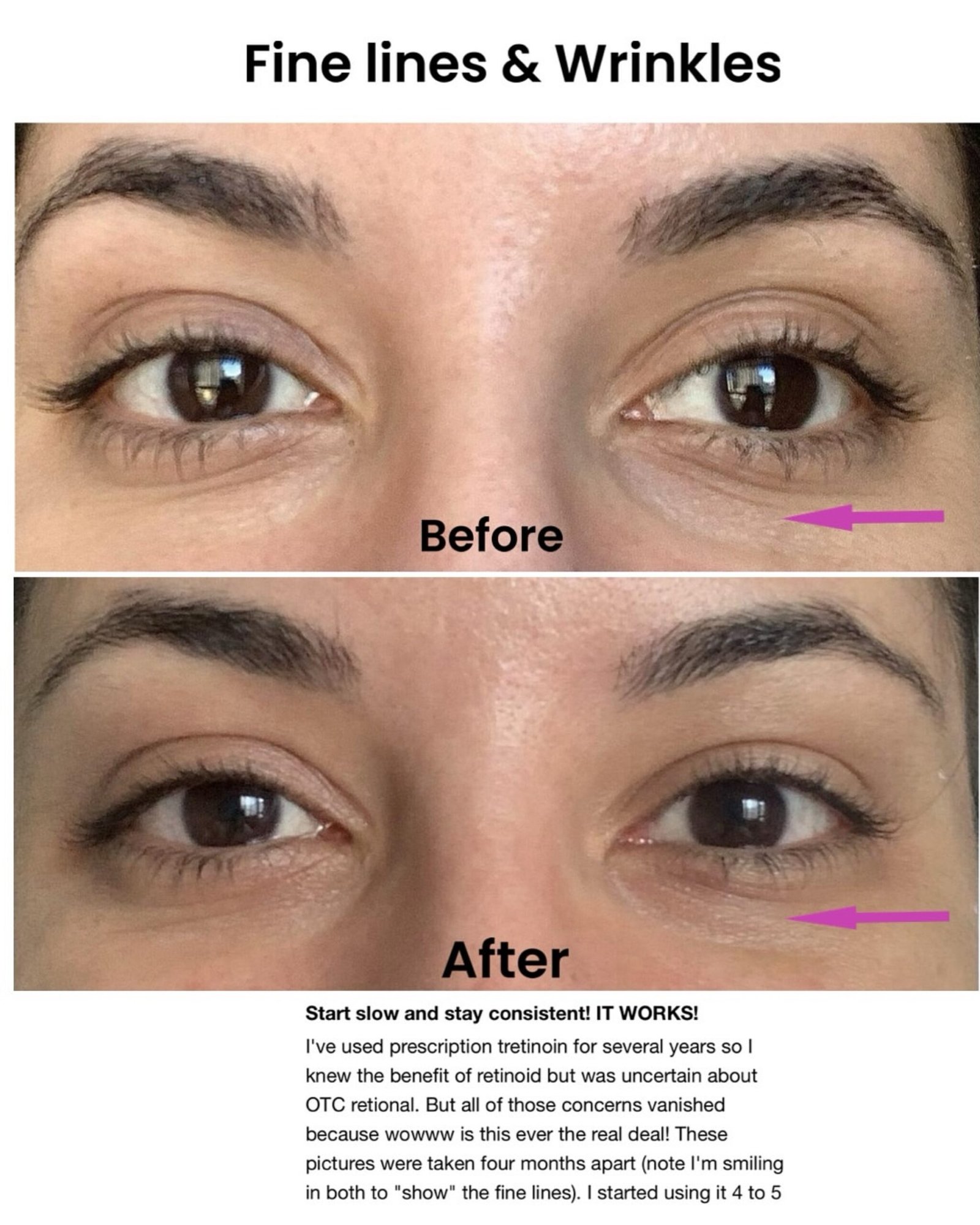 The INKEY List Retinol Eye Cream - Image 3