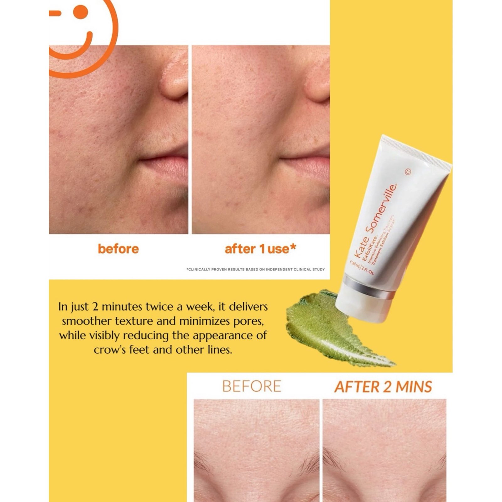 Kate Somerville Exfolikate Intensive Exfoliating Treatment - Image 4