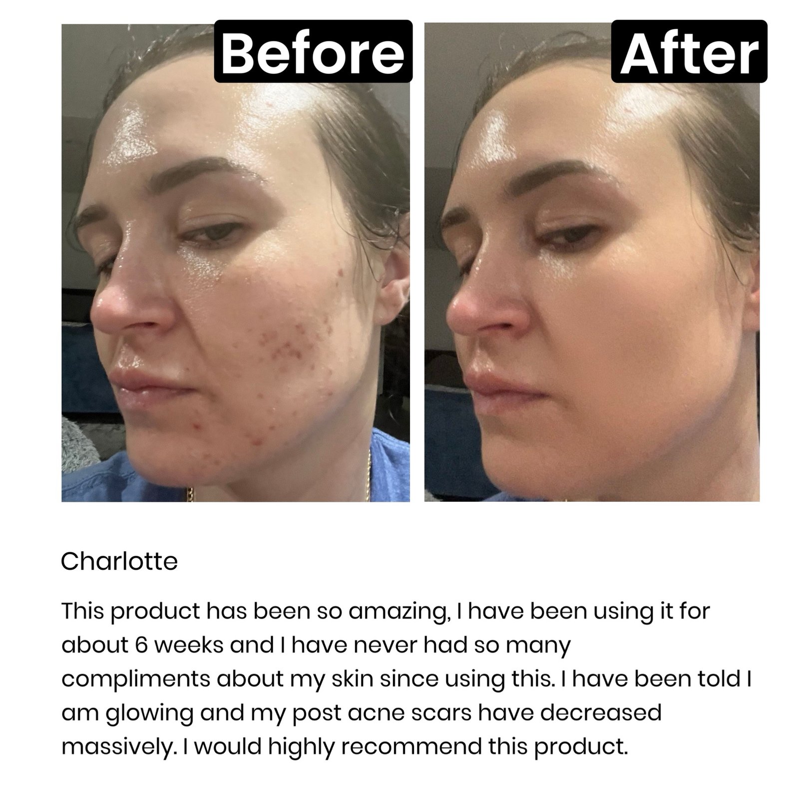 The Inkey List 1% Retinol Serum - Image 4