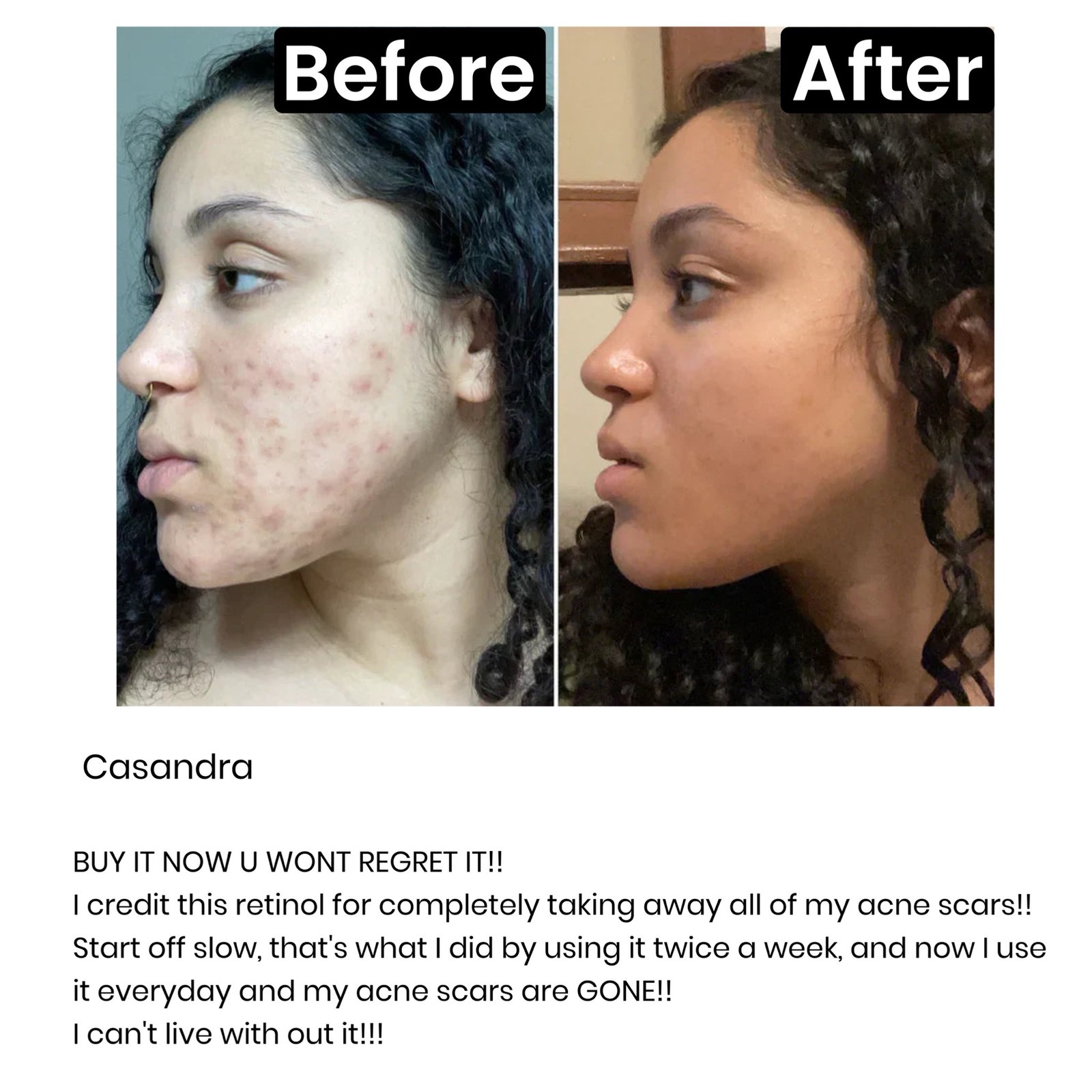 The Inkey List 1% Retinol Serum - Image 2