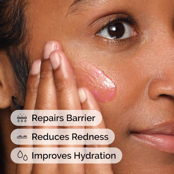 The Ordinary Soothing & Barrier Support, 30ml. - Image 5