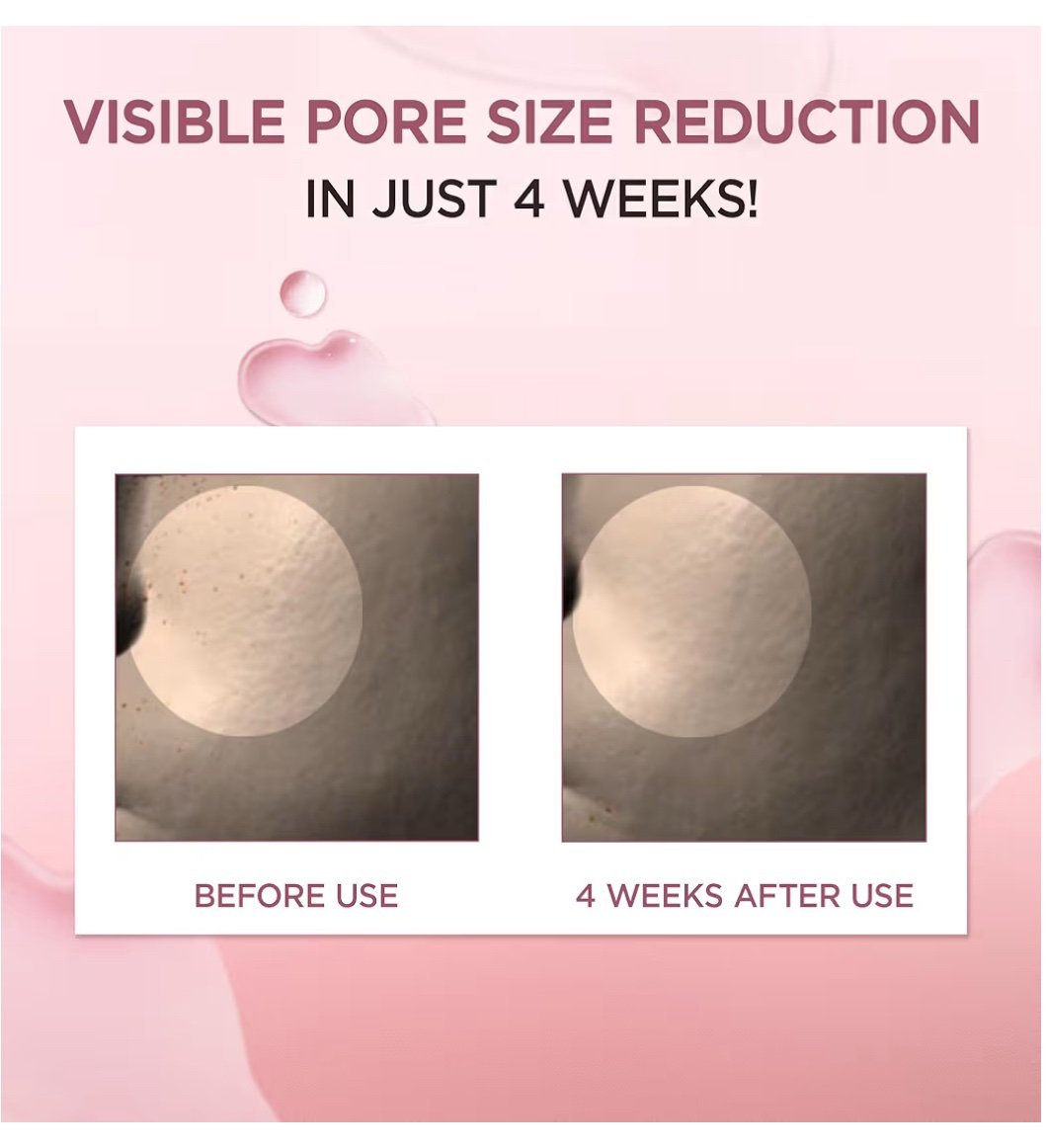 SKIN1004 Madagascar Centella Poremizing Fresh Ampoule, 100ml - Image 4