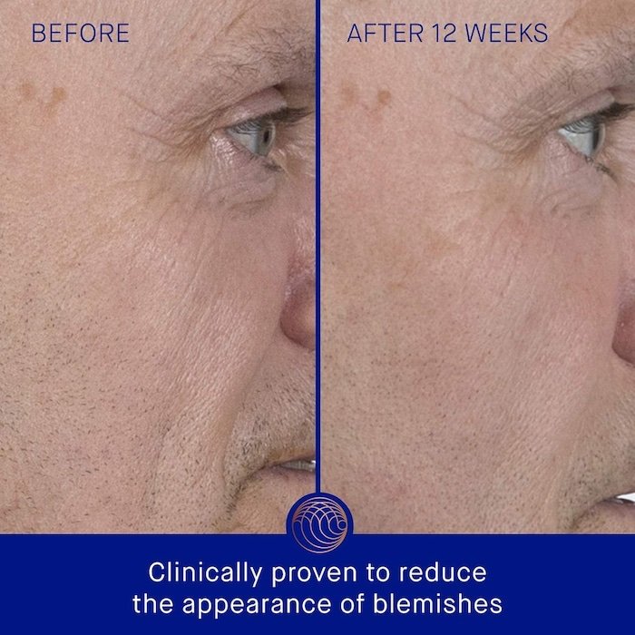 Augustinus Bader The Serum with TFC8® (unboxed), 15ml - Image 2