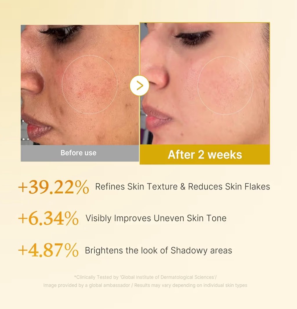 Medicube Kojic Acid Turmeric Resurfacing Toner - Image 3