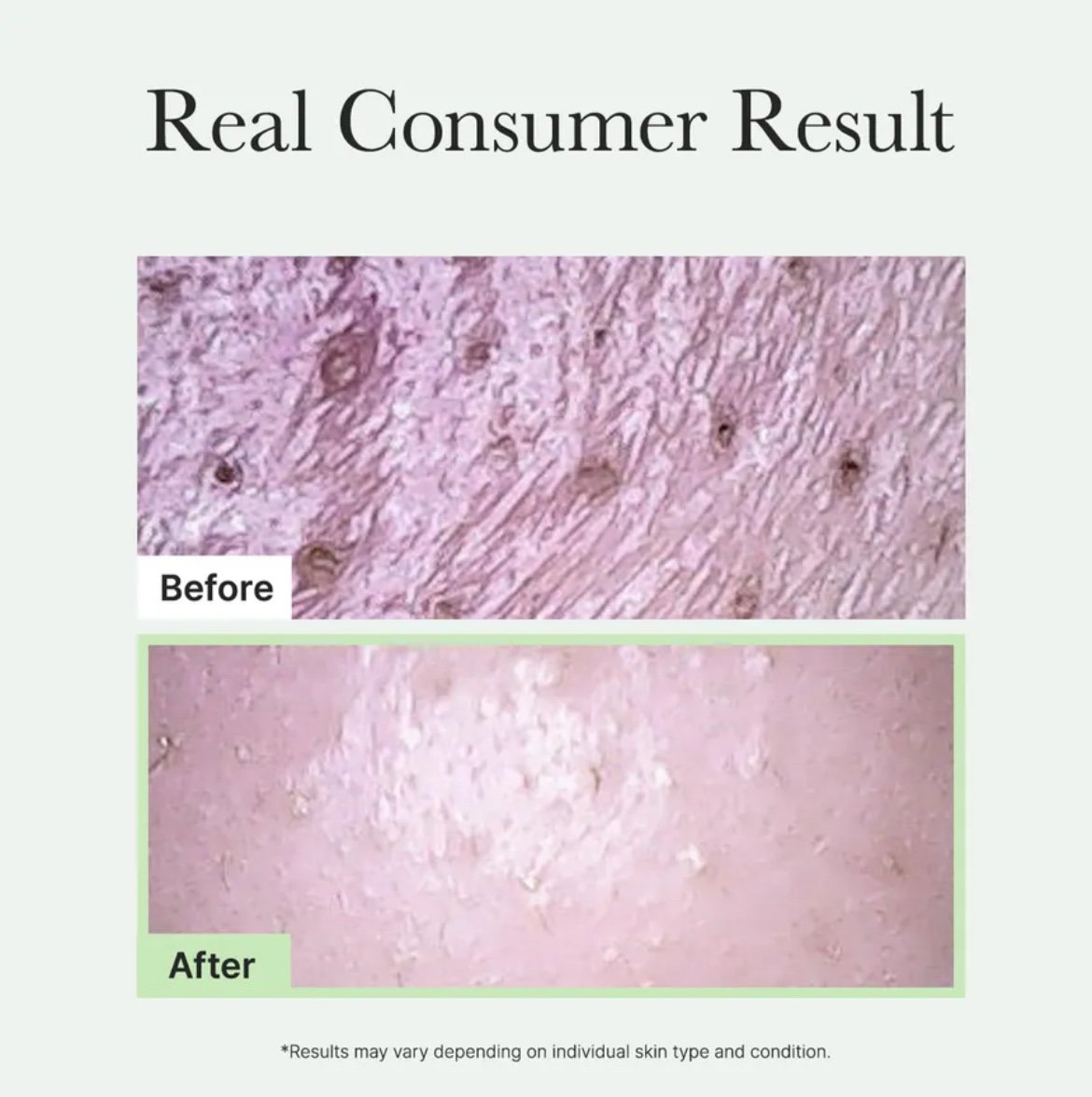 Arencia Fresh Green Rice Mochi Cleanser - Image 7
